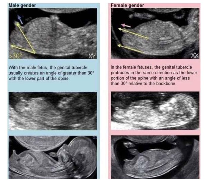 Future mamme Giugno 2021 💛🐠🍀🌻 - 1