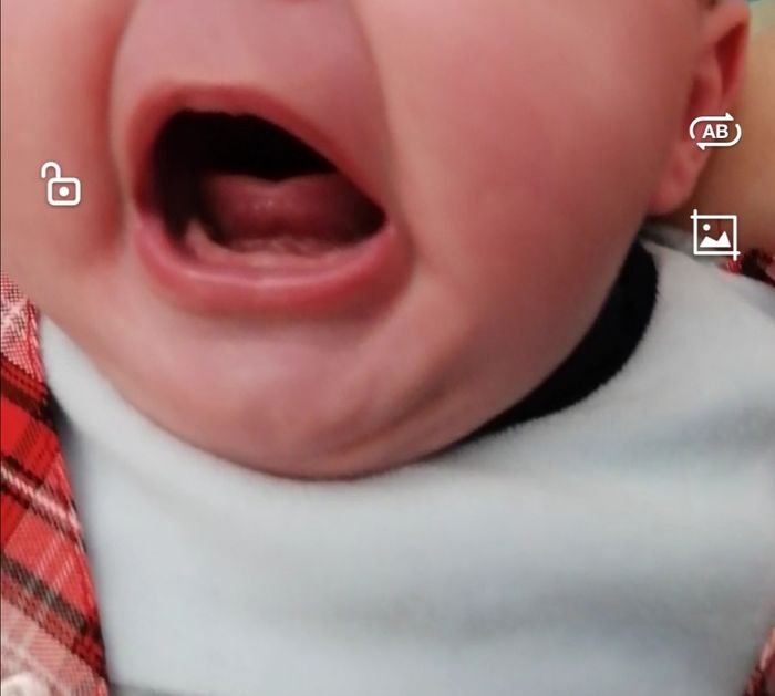 Frenulo linguale Corto? 1