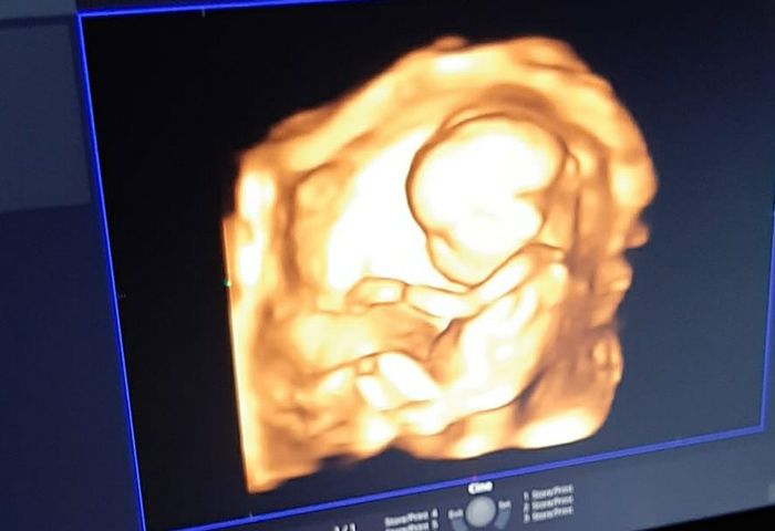 Future mamme novembre 2020 🌞🍁🌷♾ - 1