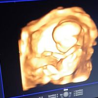 Future mamme novembre 2020 🌞🍁🌷♾ - 1