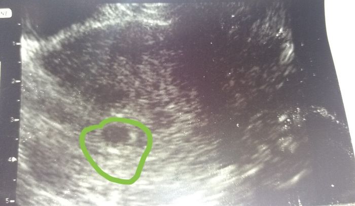 Prima ecografia 😍 - 1