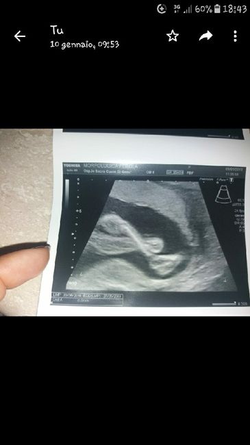 Maschio o femmina? - 1