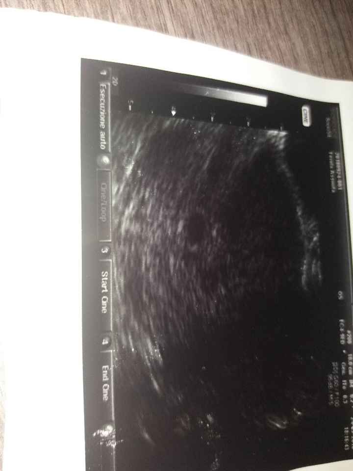 Quante camere gestazionali vedete? - 1