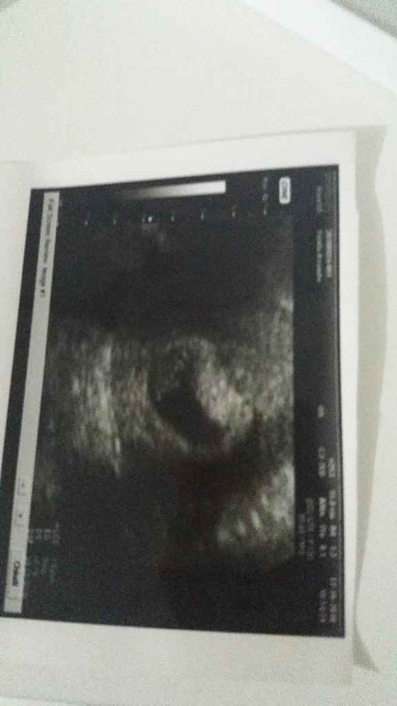 Ecco il fagiolino - 1