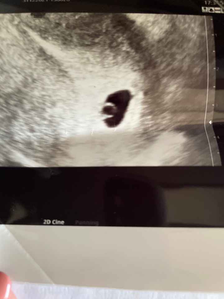 Future mamme Dicembre 2023 - 1