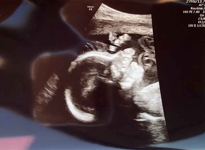 Future mamma settembre 2019 - 1