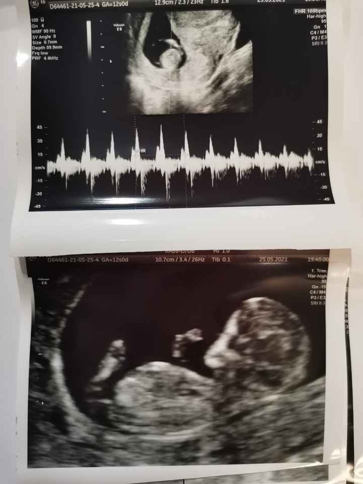 Future mamme Dicembre 2021 🎄🎁💙🎀 - 1