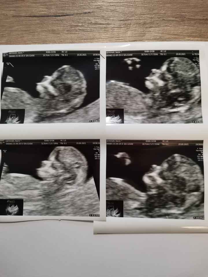 Future mamme Dicembre 2021 🎄🎁💙🎀 - 2