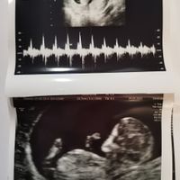 Future mamme Dicembre 2021 🎄🎁💙🎀 - 1