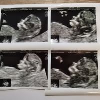 Future mamme Dicembre 2021 🎄🎁💙🎀 - 2