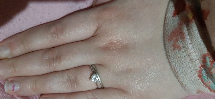 Anello di fidanzamento 💍 - 1