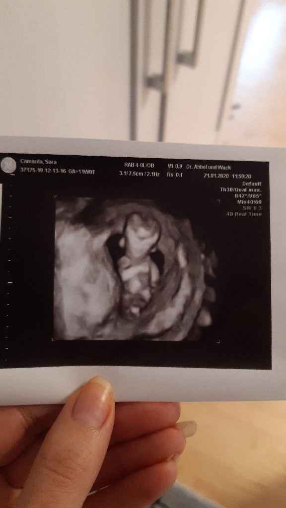 Mamme di Agosto 2020😍🤞😍 - 1