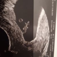 Mamme di Agosto 2020😍🤞😍 - 1