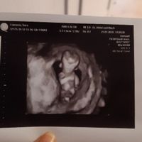 Mamme di Agosto 2020😍🤞😍 - 1