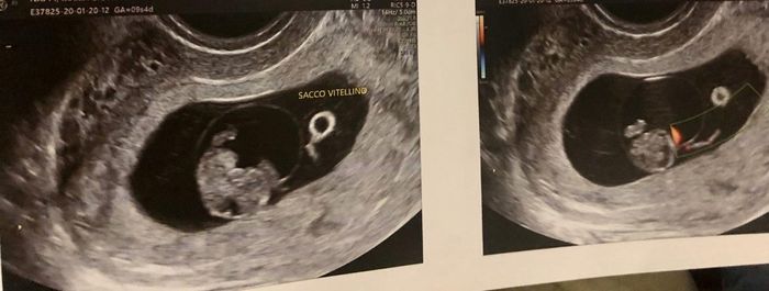 Metodo Ramzi! Chi ci sa azzeccare? 1