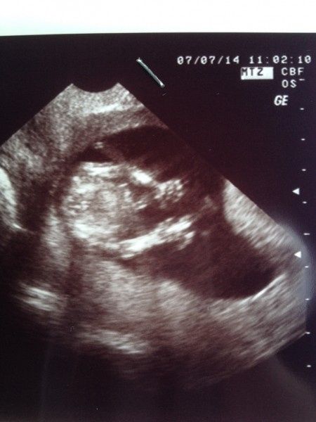 Il suo primo selfie! - 2