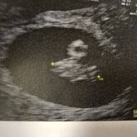 Future Mamme Aprile 2024 - 1