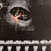 Future Mamme Aprile 2024 - 1