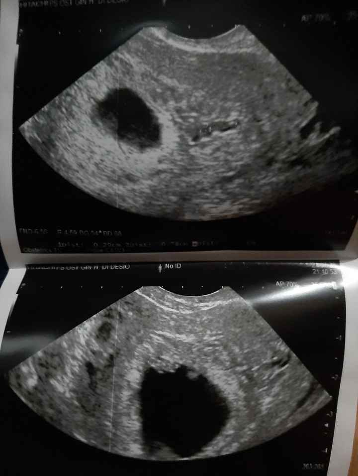 Metodo Ramzi! Chi ci sa azzeccare? - 1