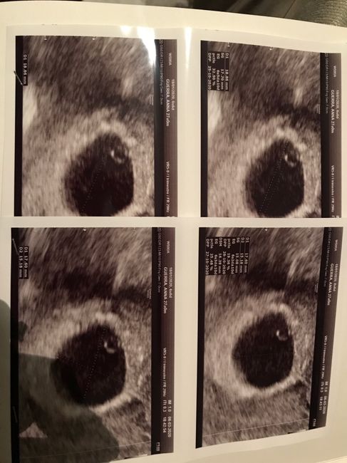 Future mamme ottobre 2020 1