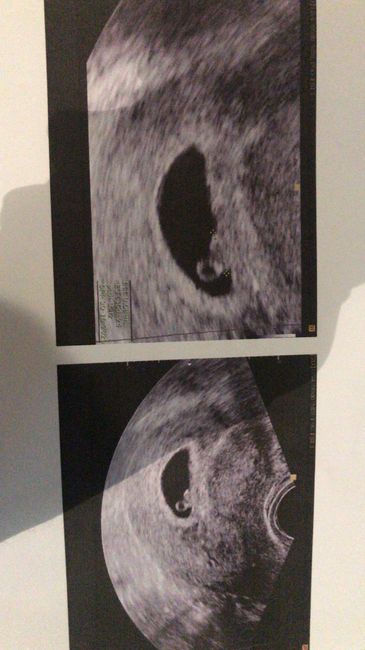 Future mamme ottobre 2020 1