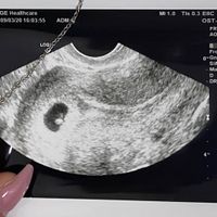 Metodo Ramzi maschio o femmina chi prova ad indovinare ?? Eco interna - 1