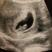 Metodo Ramzi! Chi ci sa azzeccare? - 1