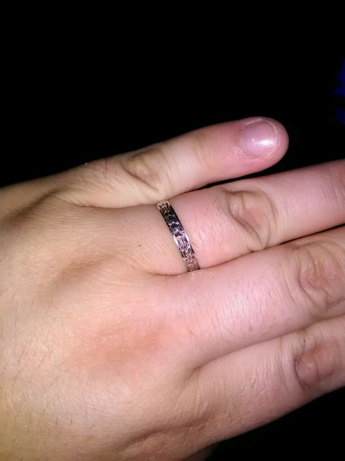 La foto del vostro anello! - 1
