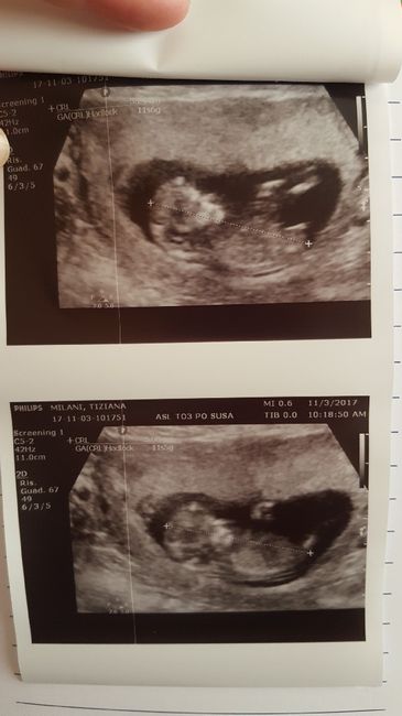 Future mamme maggio-giugno/2018 2