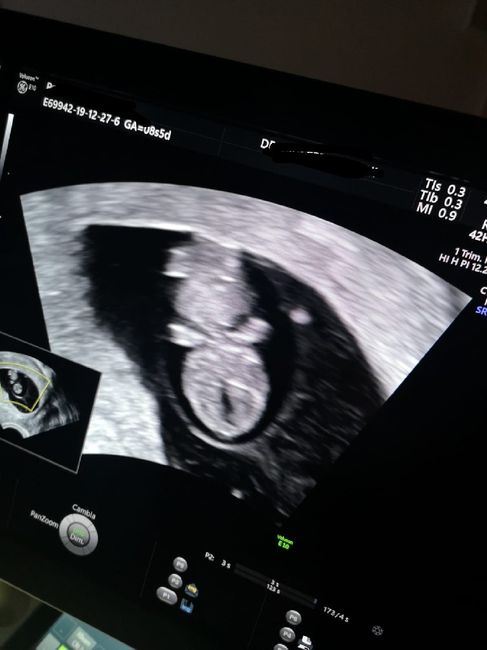Mamme di Agosto 2020😍🤞😍 - 1