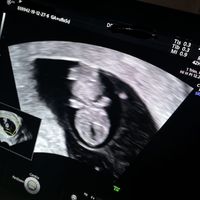 Mamme di Agosto 2020😍🤞😍 - 1