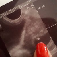 😍😍😍😍 - 2