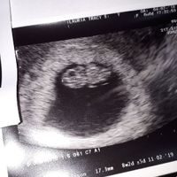 😍😍😍😍 - 1