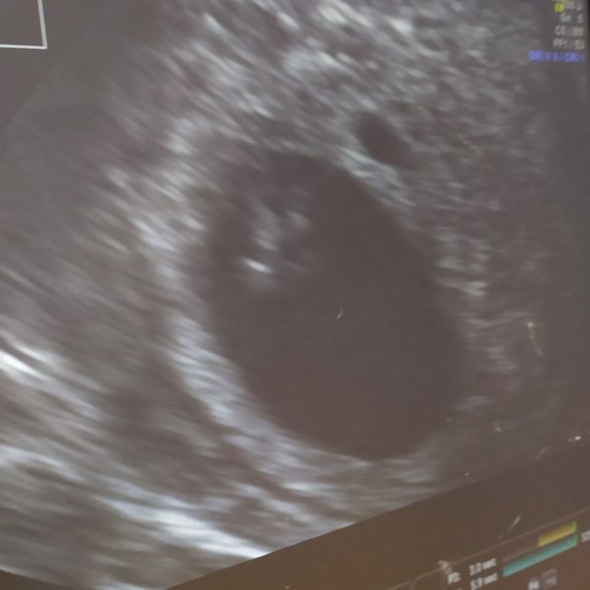 Future Mamme Settembre 2021😍 - 2