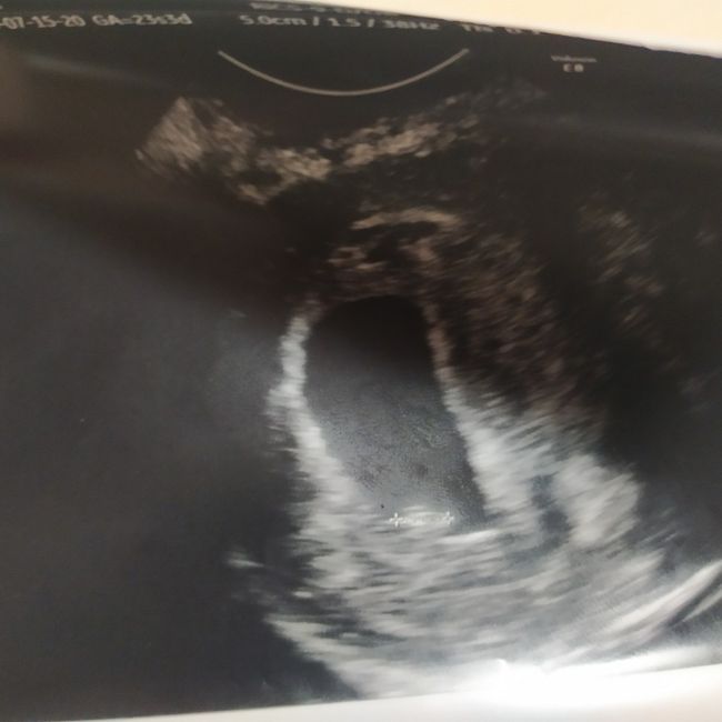 Future Mamme Settembre 2021😍 - 1