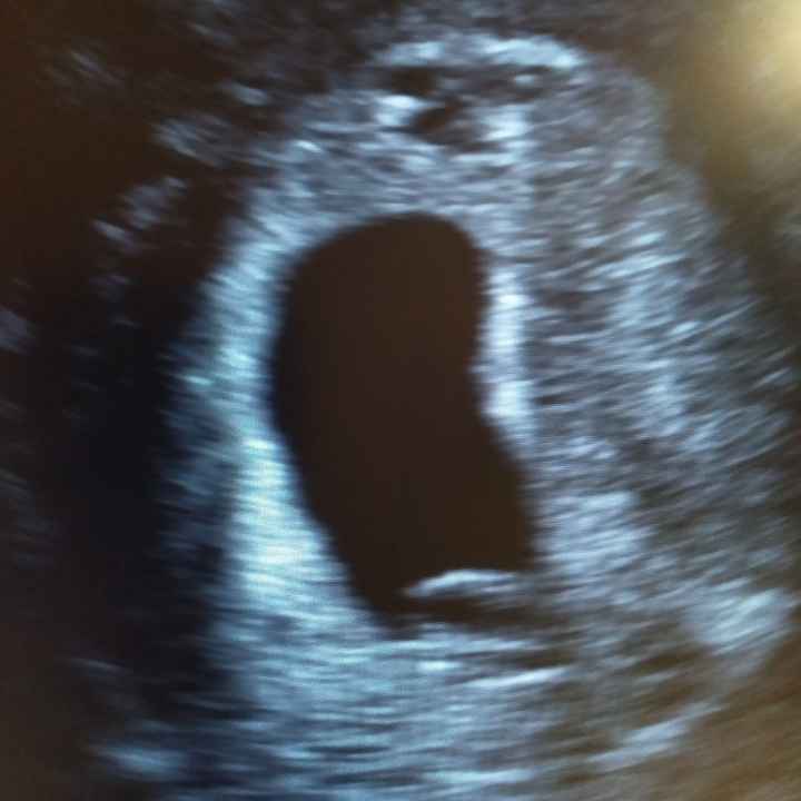 Future Mamme Settembre 2021😍 - 1