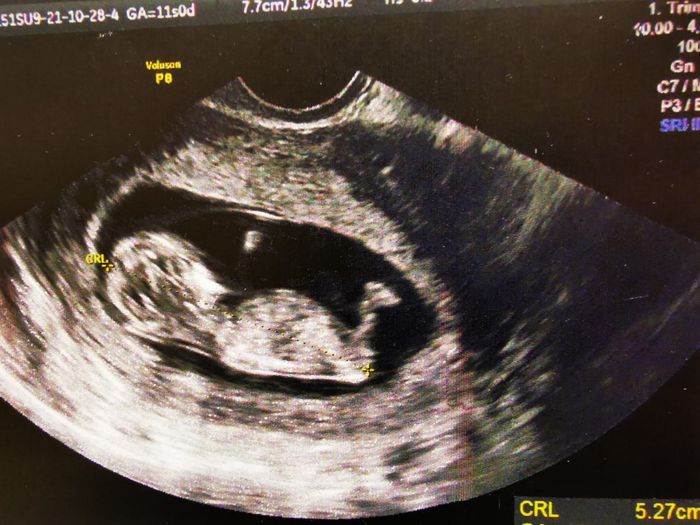 💙💜future mamme di Maggio 2022💙💜 - 1