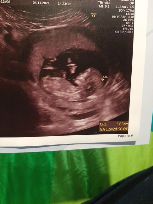 💙💜future mamme di Maggio 2022💙💜 - 1