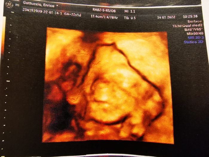 💙💜future mamme di Maggio 2022💙💜 - 1