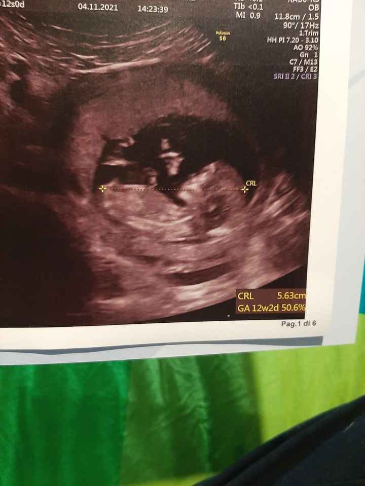 💙💜future mamme di Maggio 2022💙💜 - 1