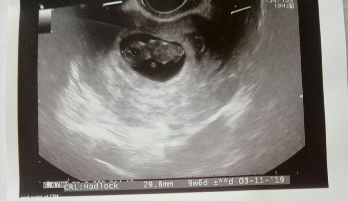 Future mamme di novembre 1