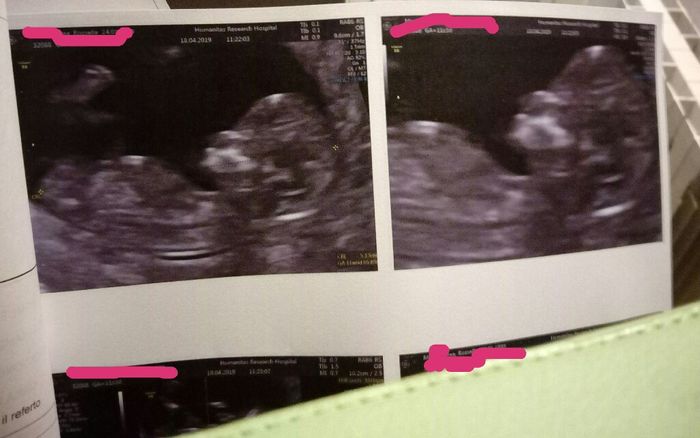 Future mamme di novembre 1