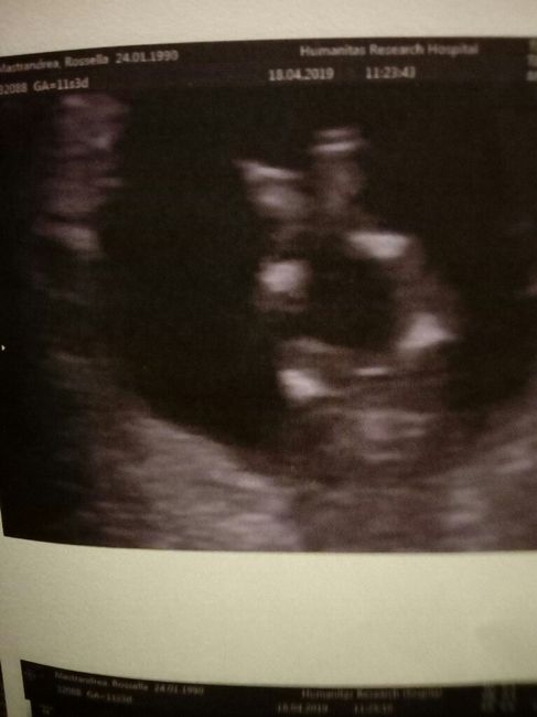 Future mamme di novembre - 1