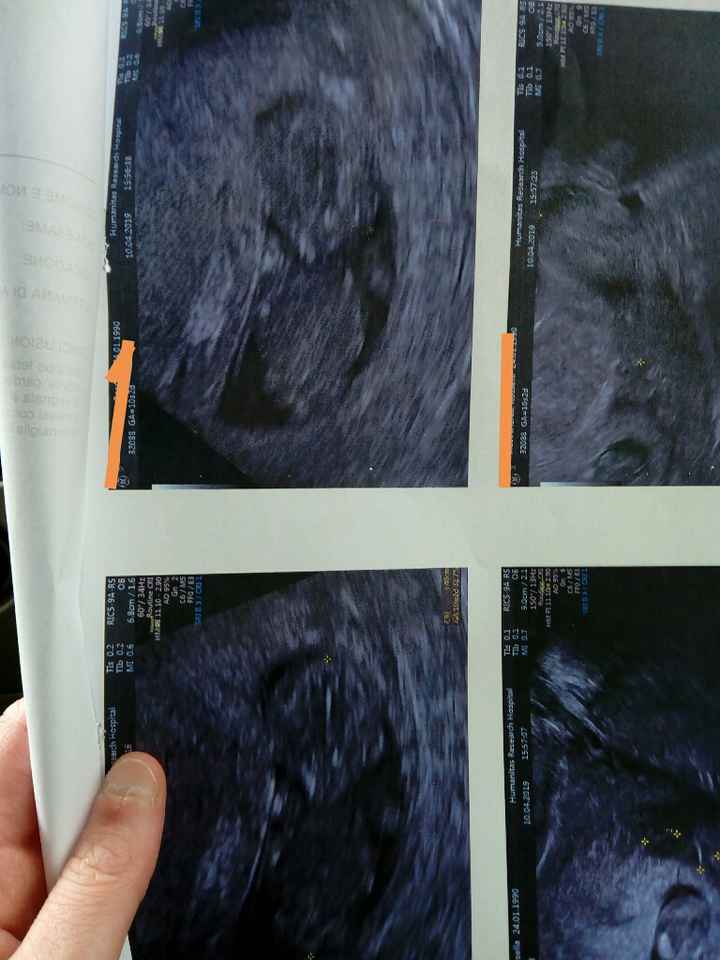 Future mamme di novembre - 2