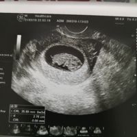 Due domandine 😜 - 1