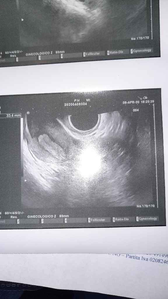 Aiuto non capisco questa ecografia - 1