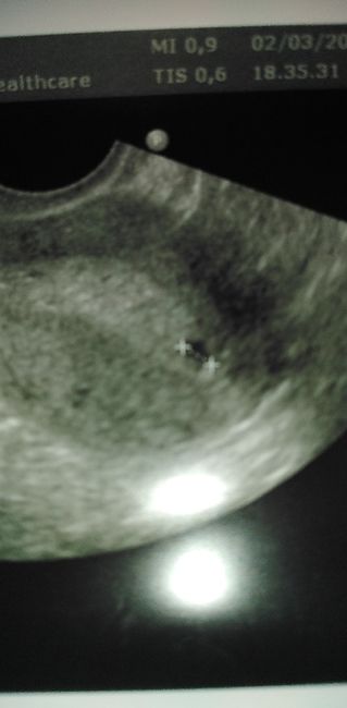 Sono in paranoia - 1