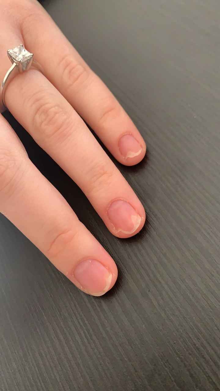 Situazione unghie precipitata rovinosamente 😭😭😭 - 1