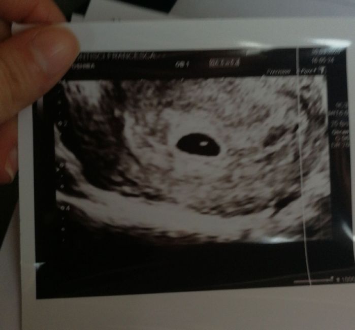 Future mamme novembre 2020 🌞🍁🌷♾ - 1