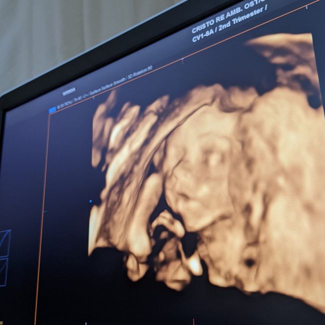 Future Mamme Maggio 2021❤️ - 1